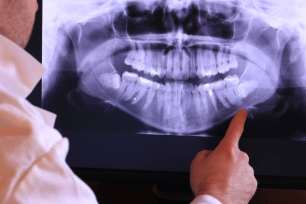 Best Emergency Dentist for Knocked-Out Tooth in Mcnair, VA