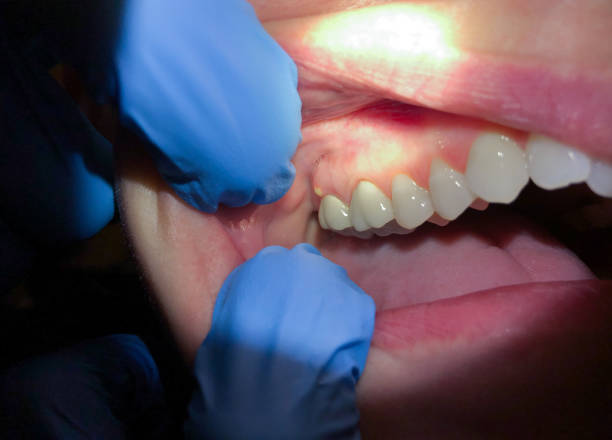 Best Orthodontic Emergency Dentist in Mcnair, VA