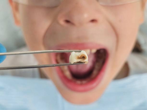 Best Holiday Emergency Dentist in Mcnair, VA